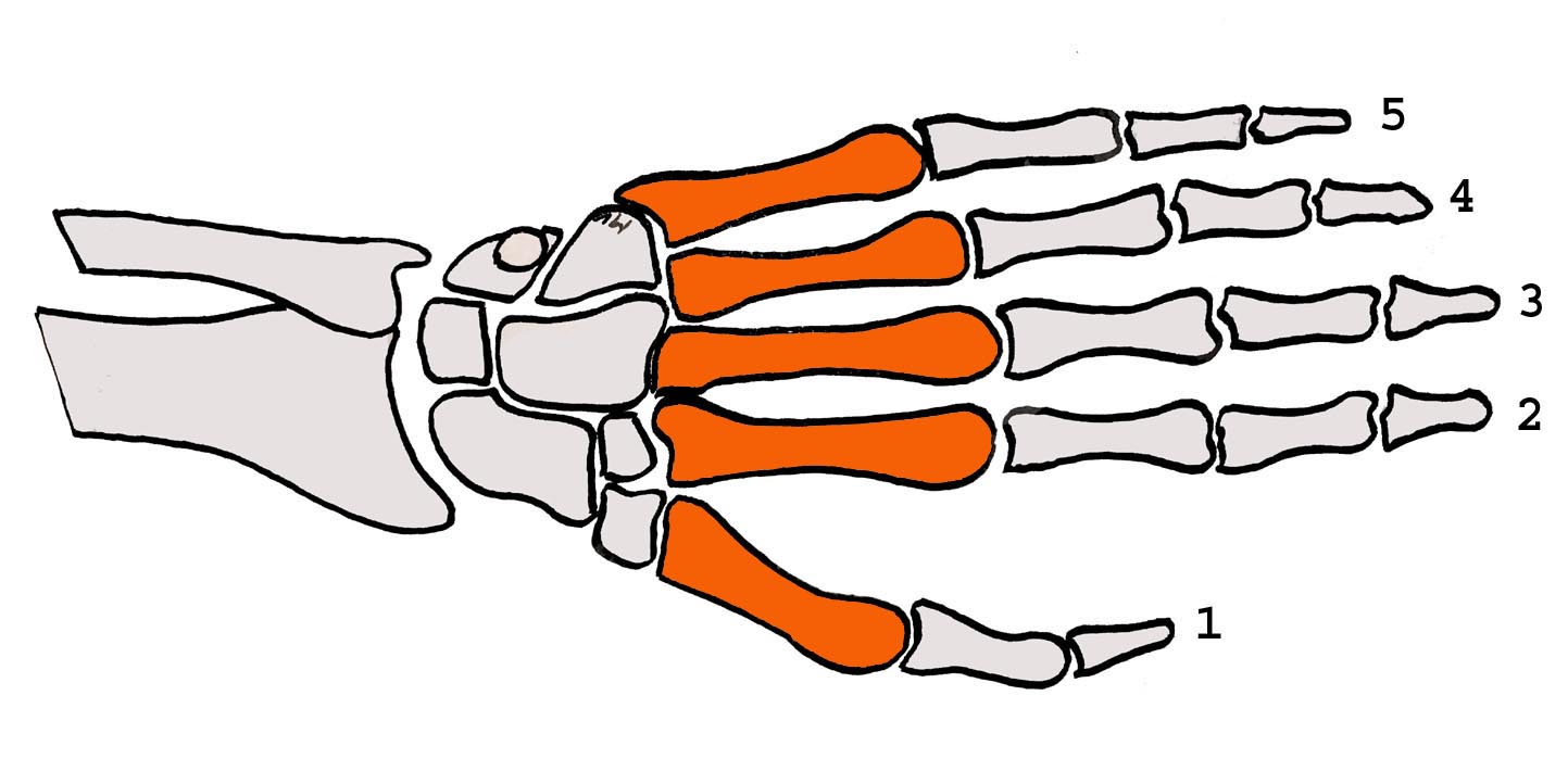 Fractures de la main L